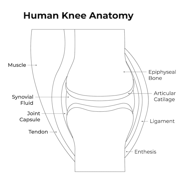A graphic illustration depicting the anatomy of a healthy knee joint versus a knee joint affected by osteoarthritis. The healthy joint shows smooth cartilage, while the osteoarthritic joint shows damaged and worn cartilage.
