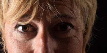 Understanding Age-Related Macular Degeneration: Early Detection and Treatment Options - Cover Image