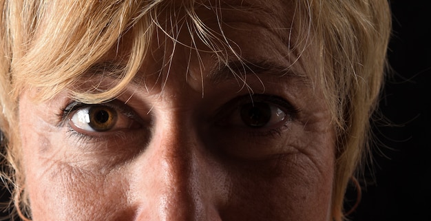 Understanding Age-Related Macular Degeneration: Early Detection and Treatment Options