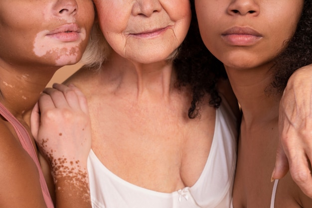 A close-up of different types of skin lesions that could indicate skin cancer, including basal cell carcinoma, squamous cell carcinoma, and melanoma, with arrows pointing to each type and labels for clarity.