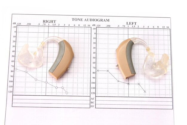 A visual comparison chart illustrating the cost difference between traditional prescription hearing aids (represented by a stack of dollar bills) and OTC hearing aids (a smaller stack). The chart clearly indicates that OTC options are significantly more affordable.